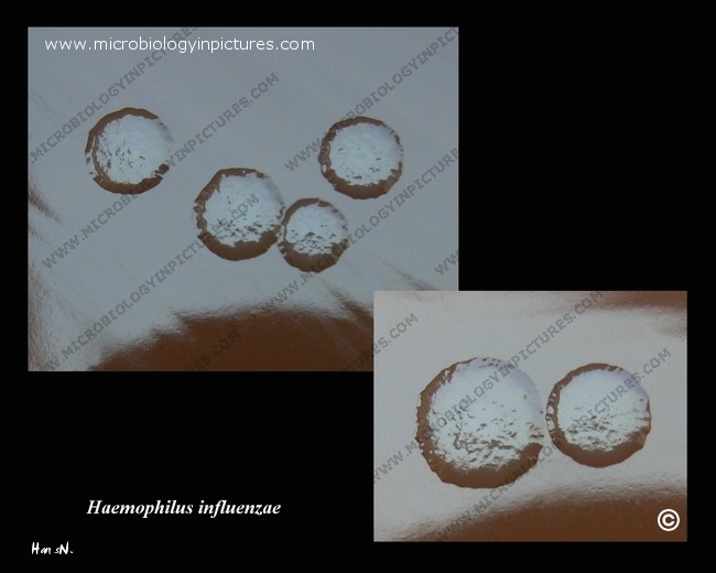 H.influenzae colony close-up h.influenzae colonies detail